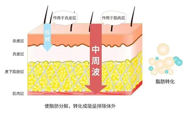 每天跳绳1000下，能瘦多少斤？学会2个方法才能真正降体脂！